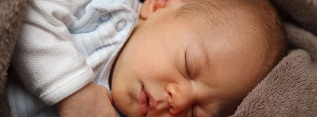 tortícolis congénita bebés